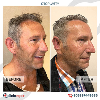 Clinic Expert Aesthetic Clinic Expert Aesthetic