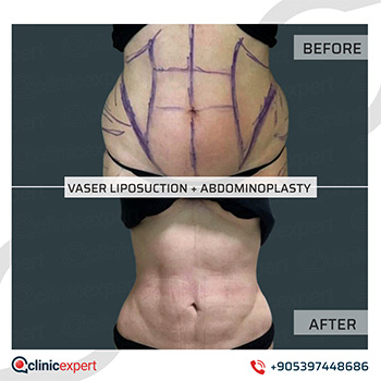 Plastic Surgery Plastic Surgery