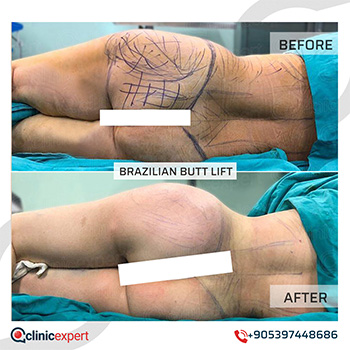 Plastic Surgery Plastic Surgery