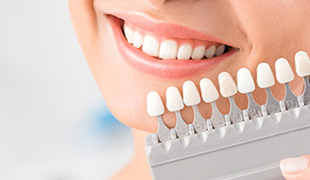 Dental Veneers