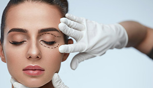 Blepharoplasty