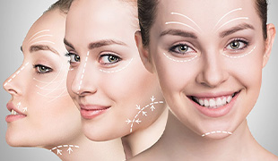 Fat Grafting/Injection