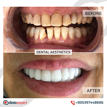 Dental Aesthetic Dental Aestheticc