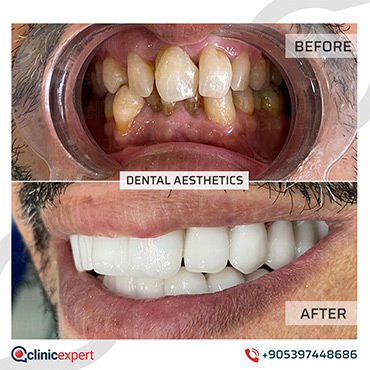 Dental Aesthetic Dental Aesthetic