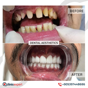 Dental Aesthetic Dental Aesthetic