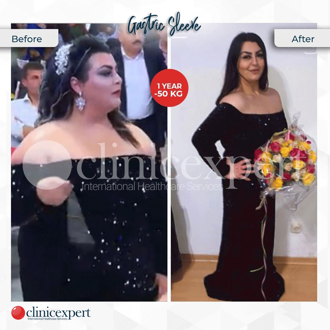 Clinicexpert Aesthetic