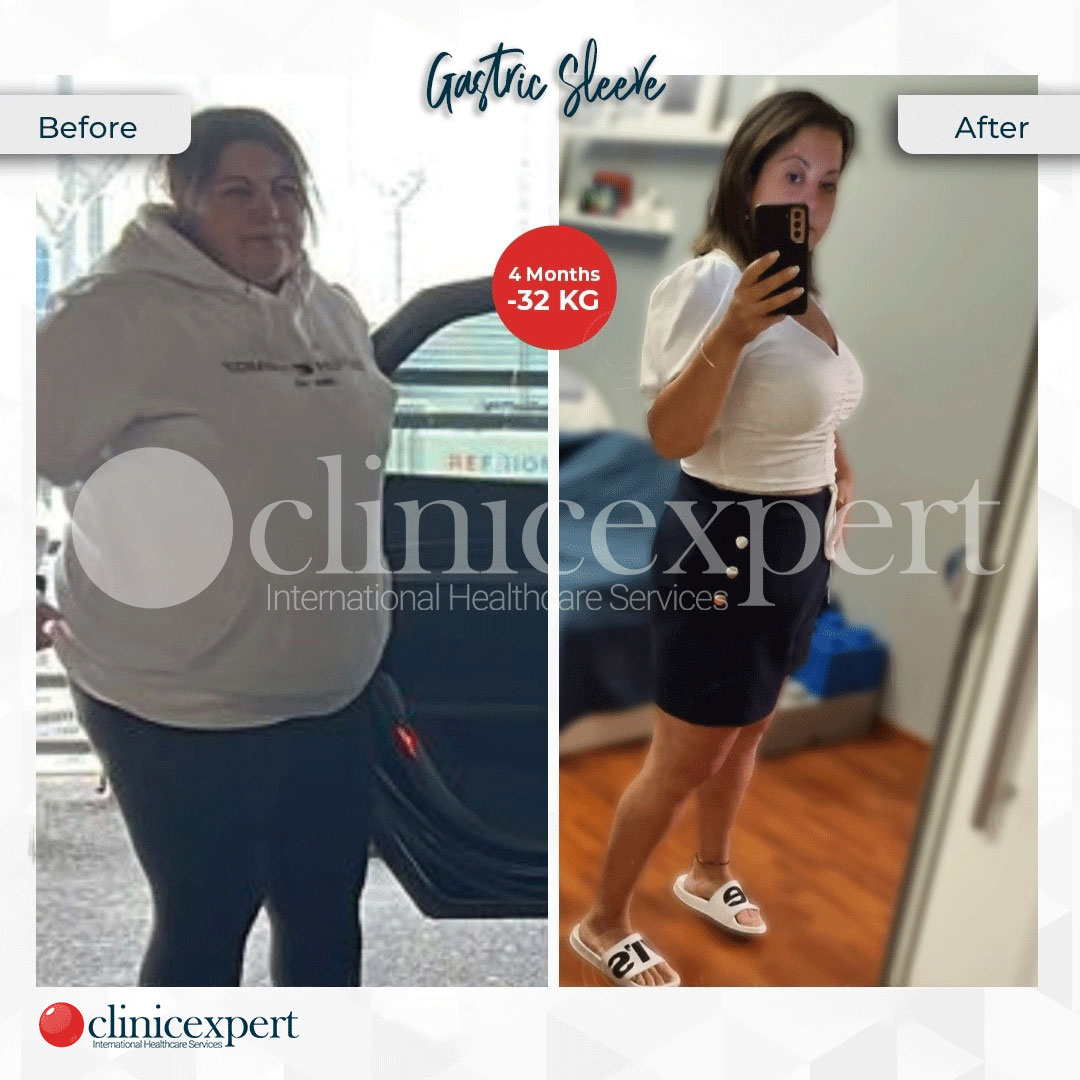 Clinicexpert Aesthetic