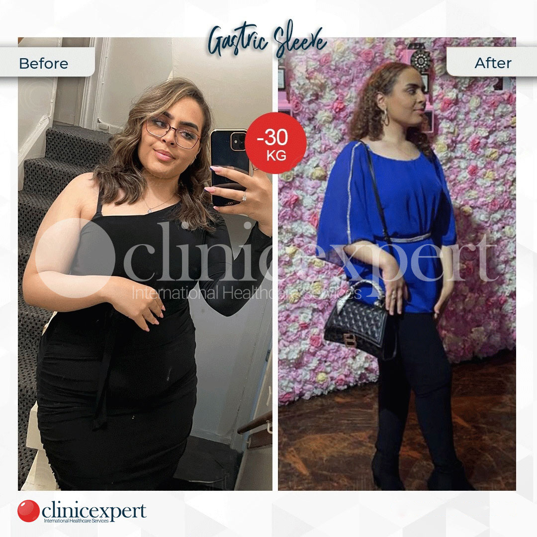 Clinicexpert Aesthetic