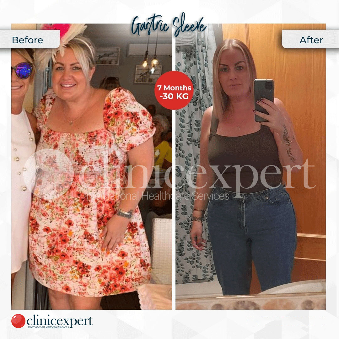 Clinicexpert Aesthetic