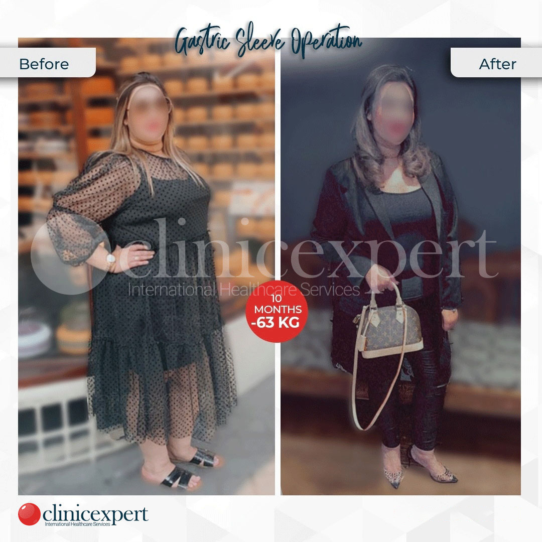 Clinicexpert Aesthetic