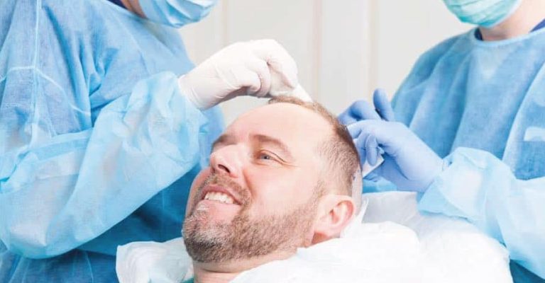 Best Hair Transplant Surgeon  