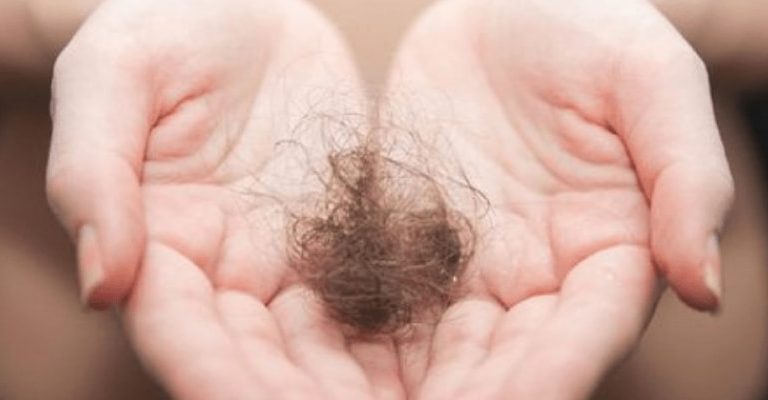 How Much Hair Loss is Normal