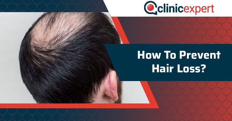 How to Prevent Hair Loss?