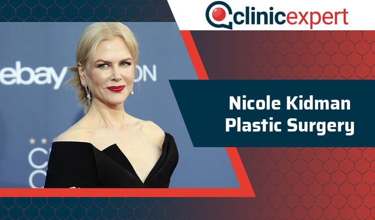 Nicole Kidman Plastic Surgery