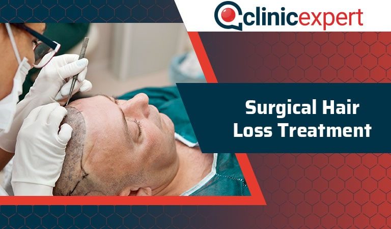 Surgical Hair Loss Treatment