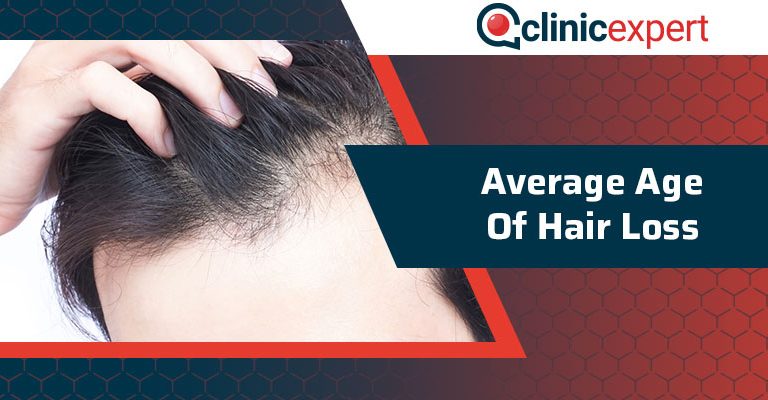 Average Age Of Hair Loss