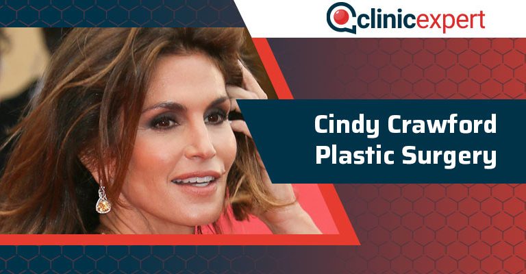 Cindy Crawford Plastic Surgery