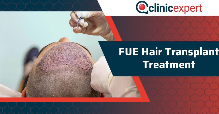 FUE Hair Transplant Treatment