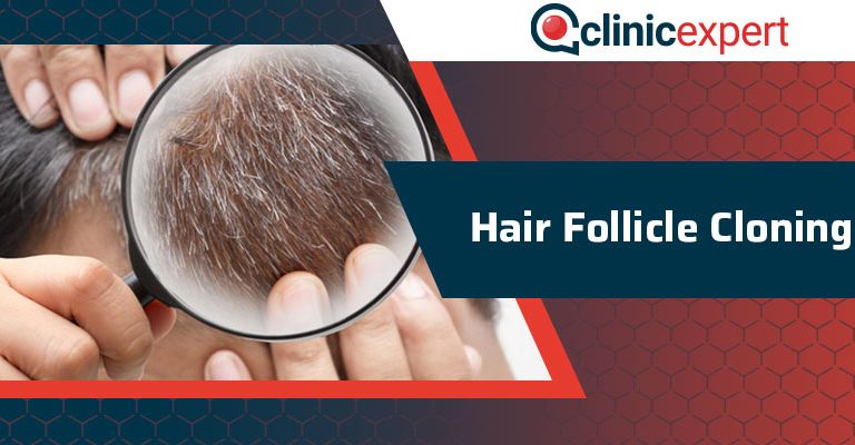 Hair Follicle Cloning