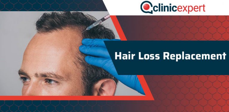 Hair Loss Replacement Clinicexpert