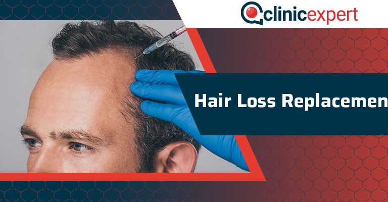 Hair Loss Replacement