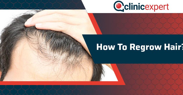 How To Regrow Hair?