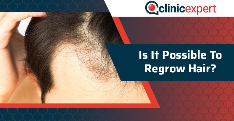 Is It Possible to Regrow Hair?