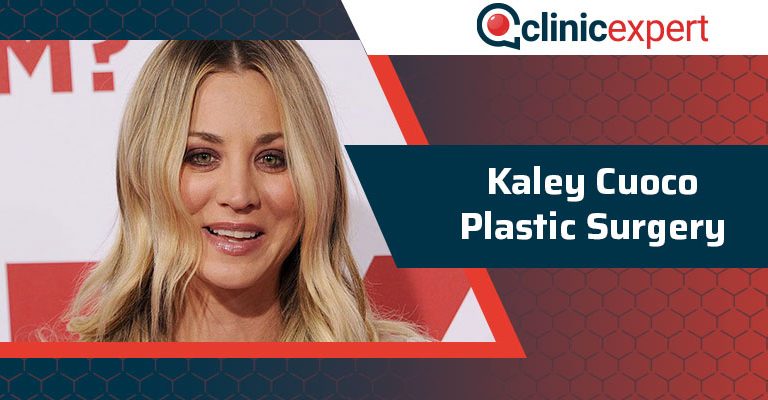 Kaley Cuoco Plastic Surgery