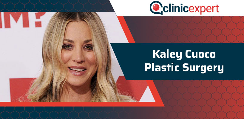 818px x 400px - Kaley Cuoco Plastic Surgery | ClinicExpert