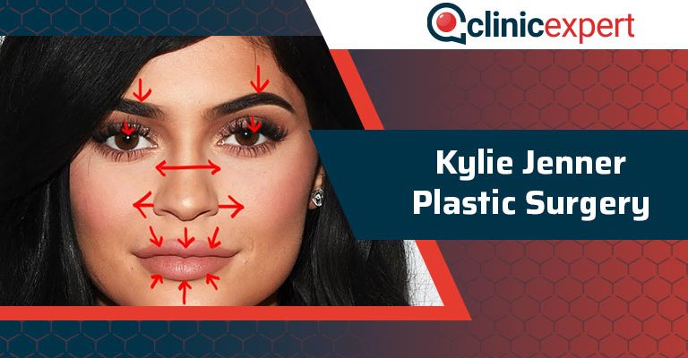 Kylie Jenner Plastic Surgery