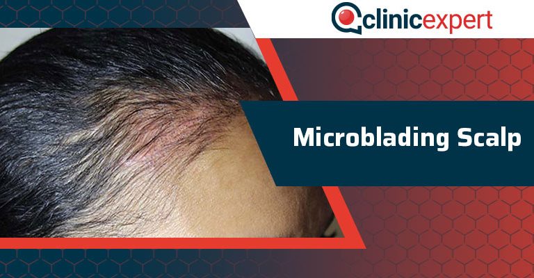 Microblading Scalp