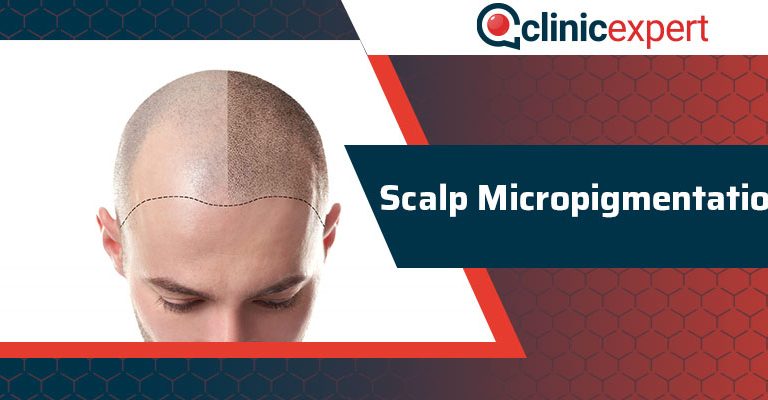 Scalp Micropigmentation