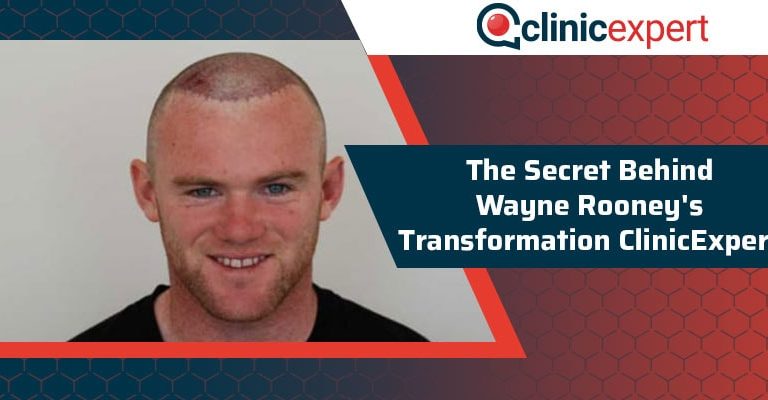 The Secret Behind Wayne Rooney's Transformation