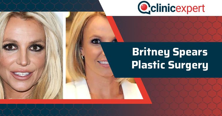 Britney Spears Plastic Surgery