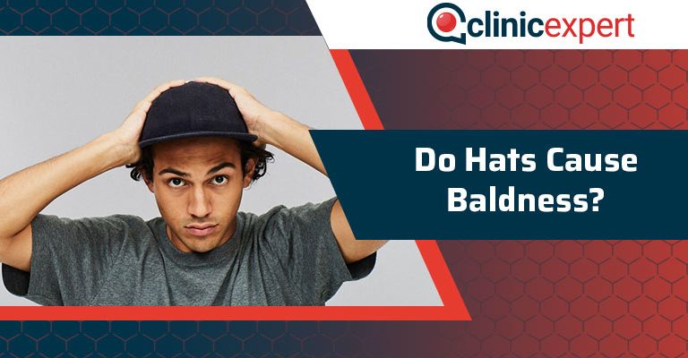 Do Hats Cause Baldness?