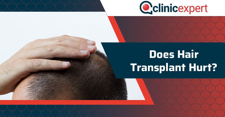 Does Hair Transplant Hurt?