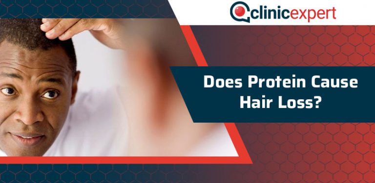 Does Protein Cause Hair Loss ClinicExpert