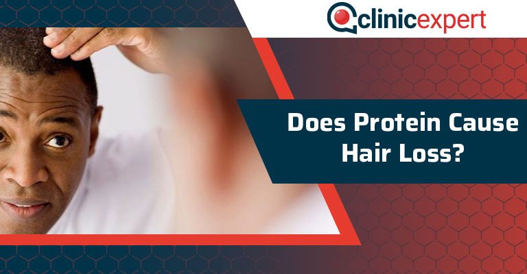 Does Protein Cause Hair Loss?