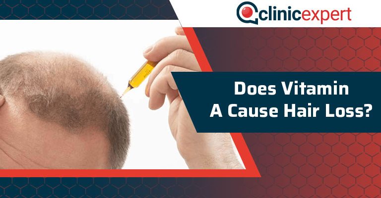 Does Vitamin A Cause Hair Loss?