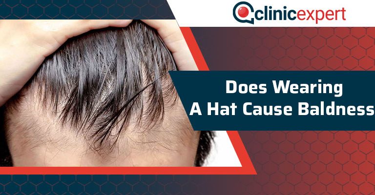 Does Wearing a Hat Cause Baldness?