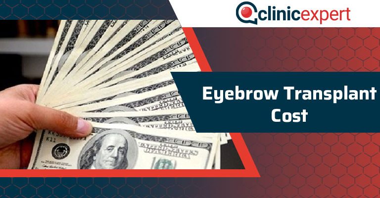 Eyebrow Transplant Cost