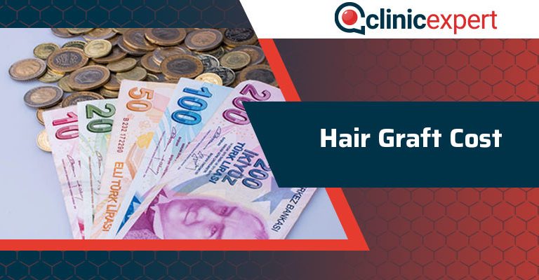 Hair Graft Cost