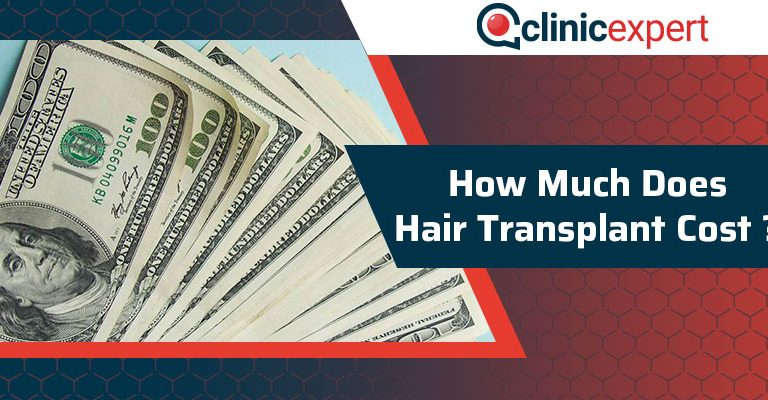 How Much Does Hair Transplant Cost?