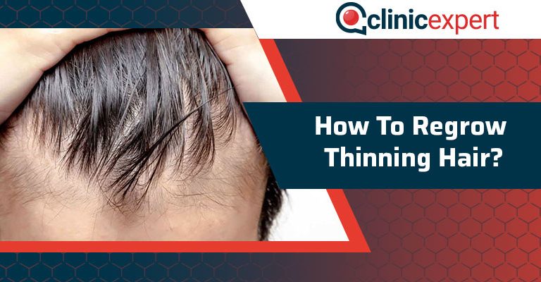 How To Regrow Thinning Hair?