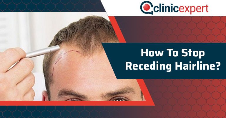 How To Stop Receding Hairline?