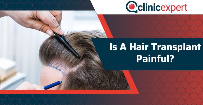 Is A Hair Transplant Painful?