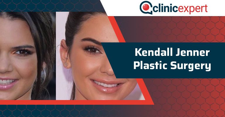 Kendall Jenner Plastic Surgery