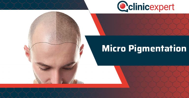 Micro Pigmentation