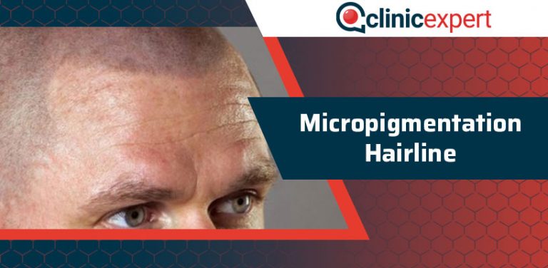 Micropigmentation Hairline | ClinicExpert