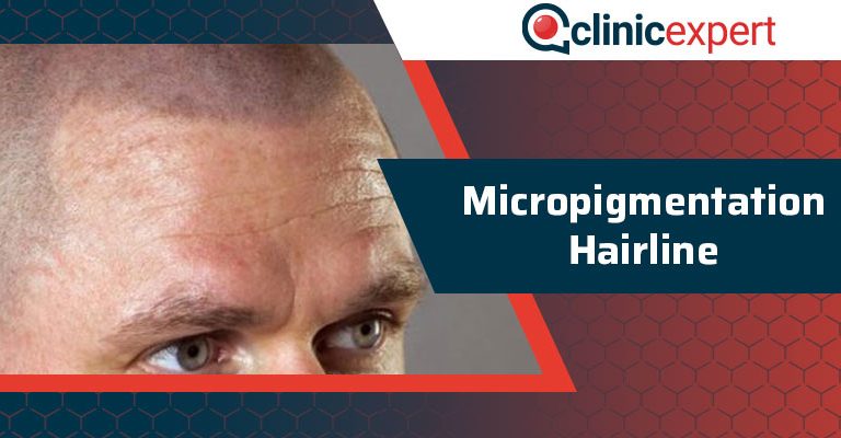 Micropigmentation Hairline